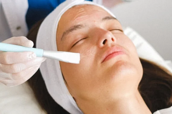 Chemical Peel Treatment in Edmonton