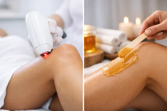 Laser vs Waxing Hair Removal: Which Lasts?