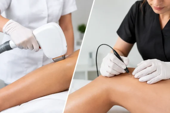 Laser Hair Removal Versus Electrolysis Compared